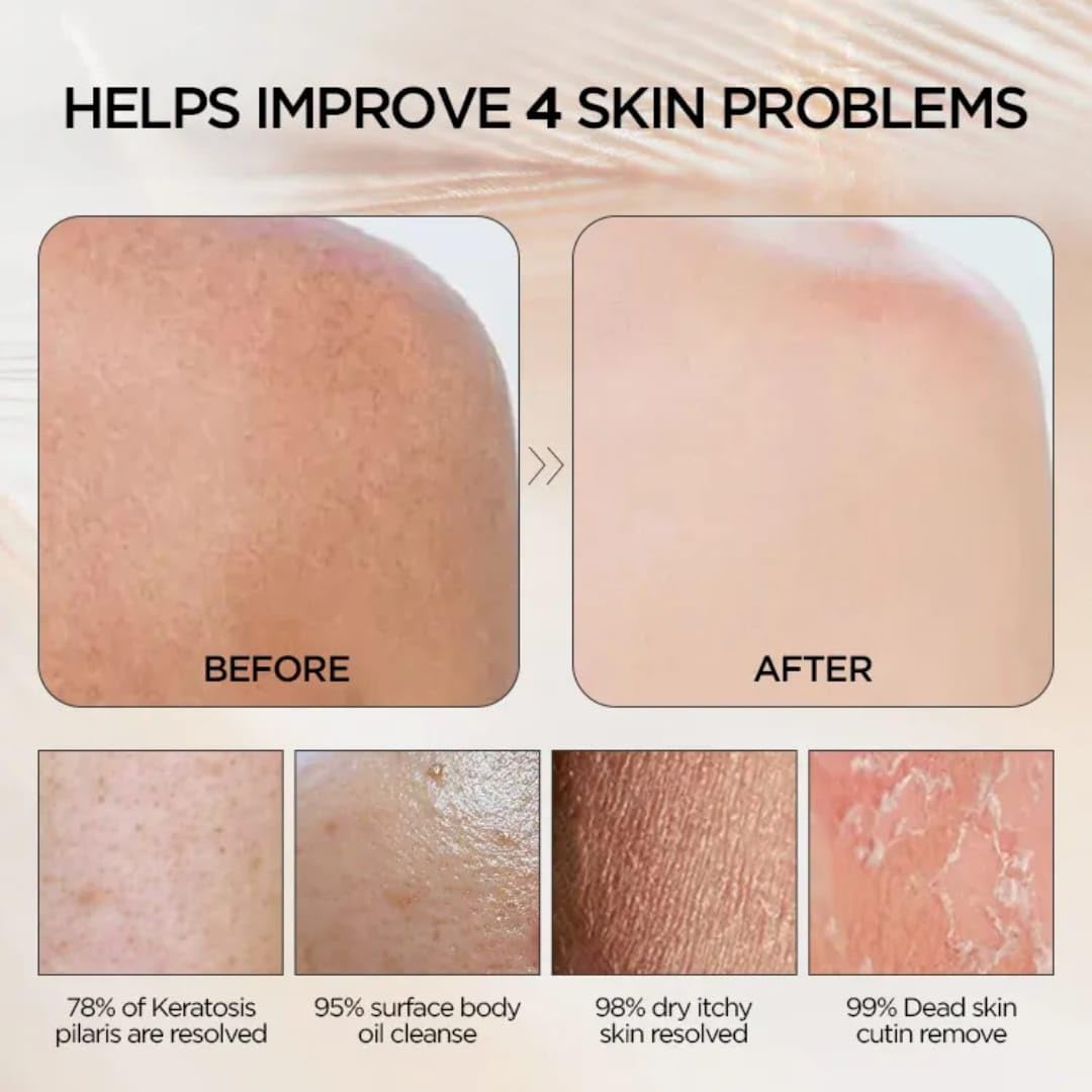 Dribble Premium Body Exfoliating Glove & Scrubber for Shower | Deep Exfoliation to Remove Dead Skin & Keratosis Pilaris | 100% Natural Viscose Fiber for Smooth Skin | Reusable Mitt for Self-Tan Prep